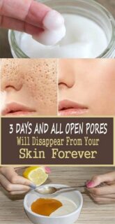 3 Days and All Open Pores Will Disappear From Your Skin Permanently !!!